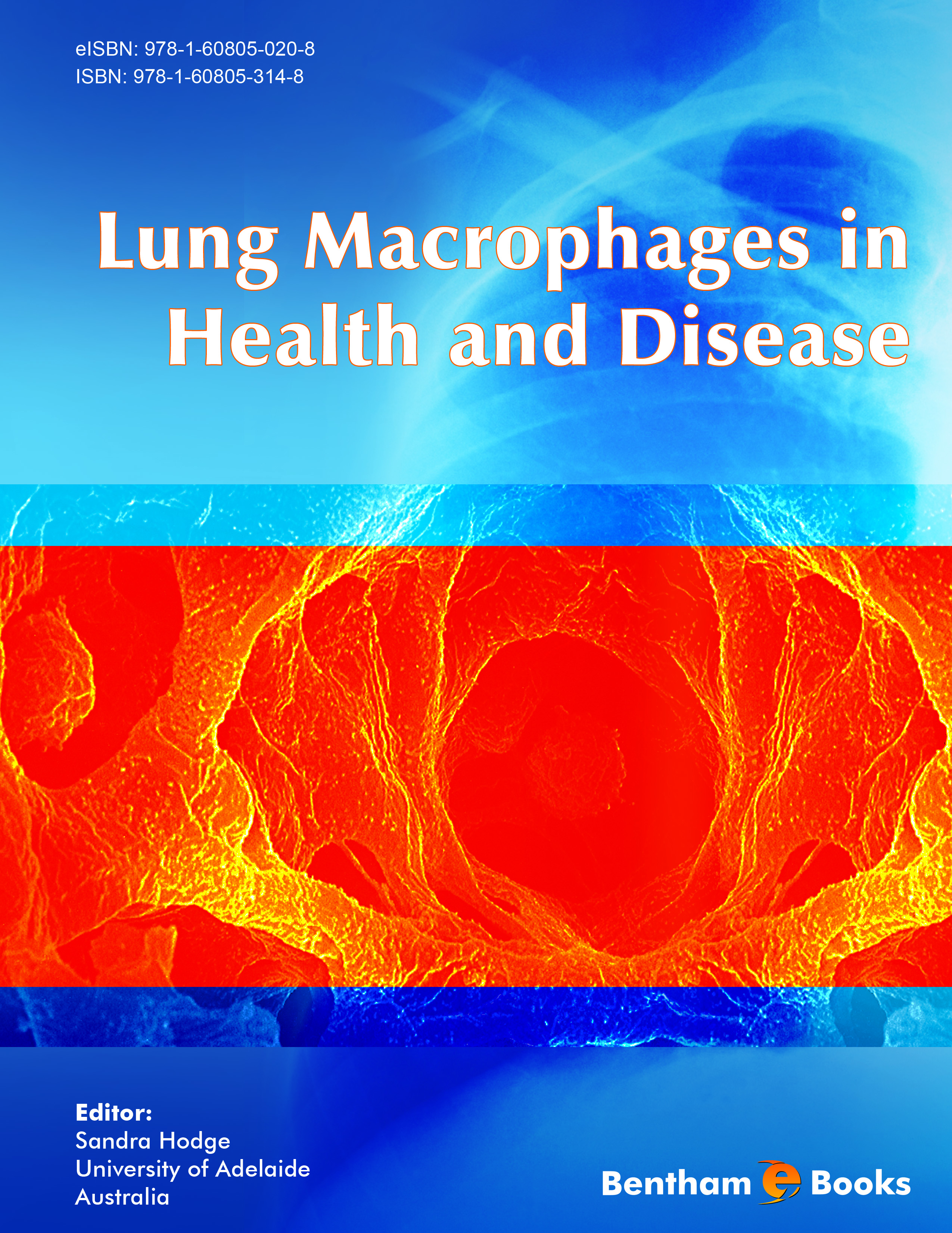 Lung Macrophages in Health and Disease