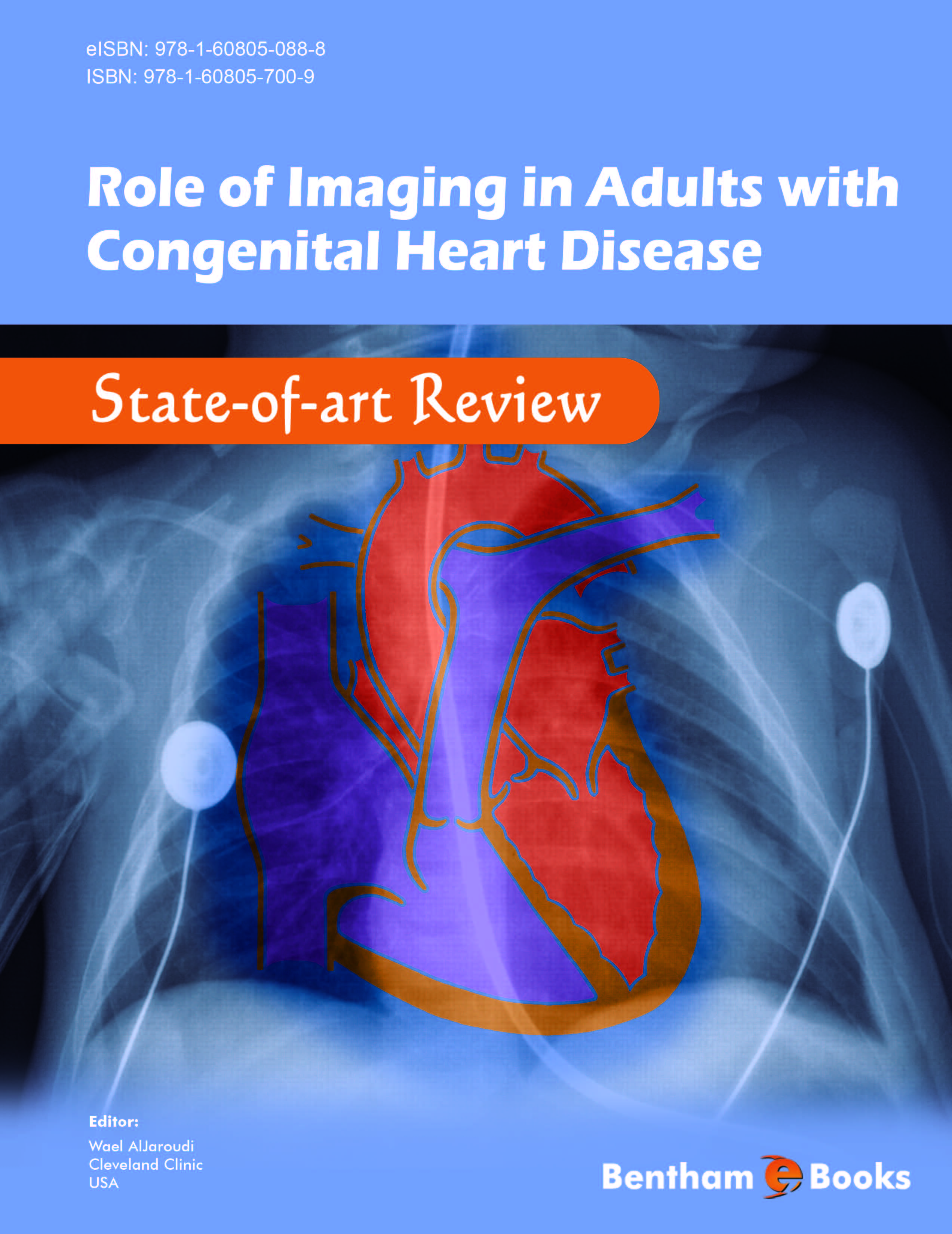 Role of Imaging in Adults with Congenital Heart Disease: State-of-art Review