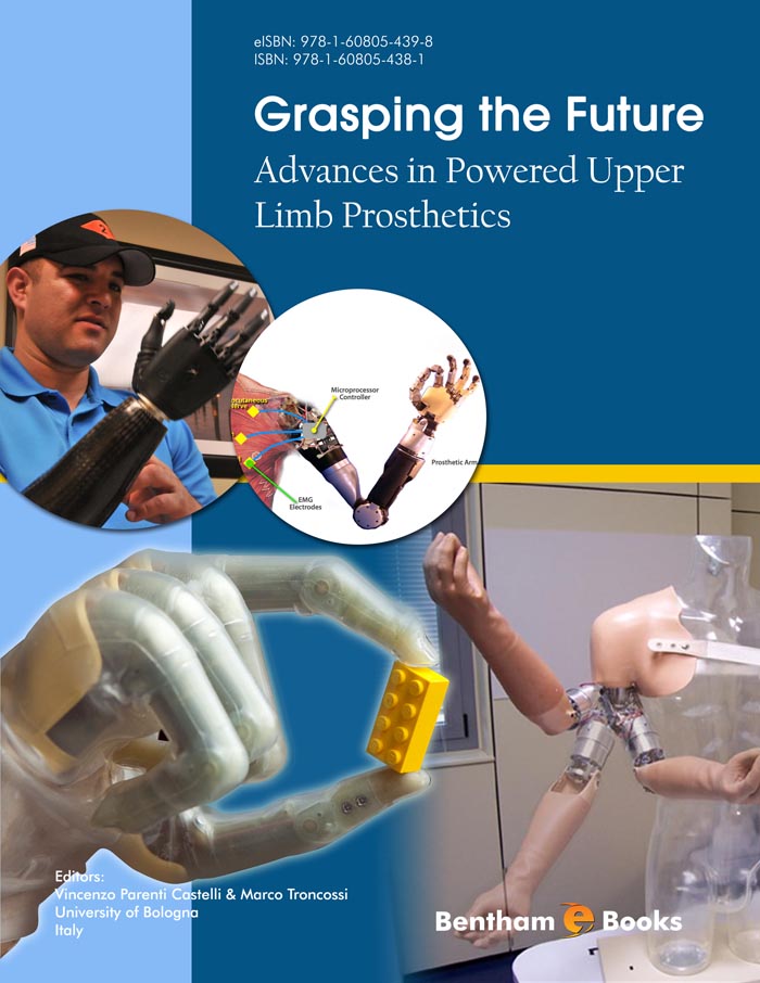 Grasping the Future: Advances in Powered Upper Limb Prosthetics