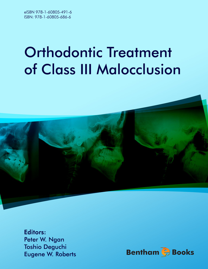 Orthodontic Treatment of Class III Malocclusion