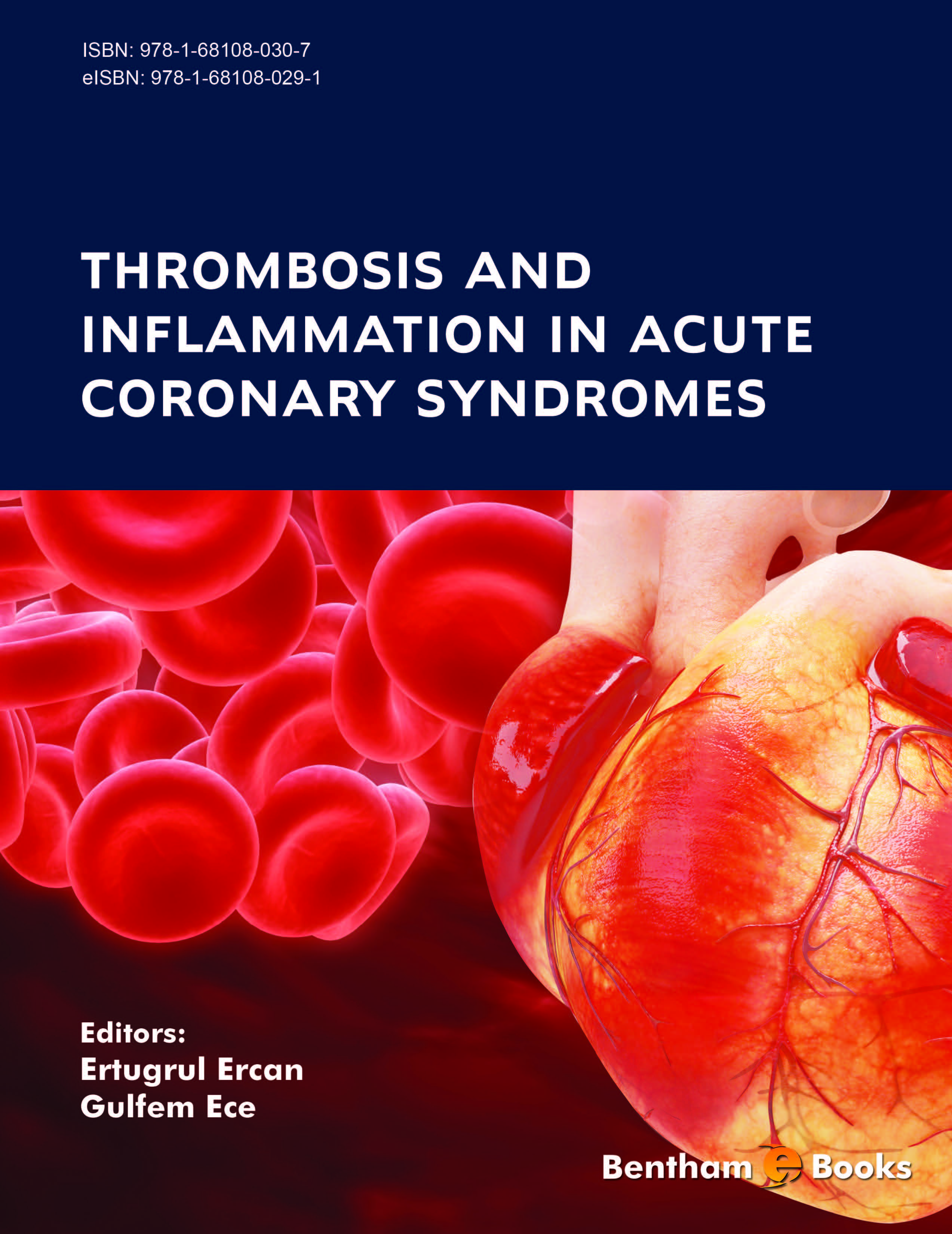 Thrombosis and Inflammation in Acute Coronary Syndromes