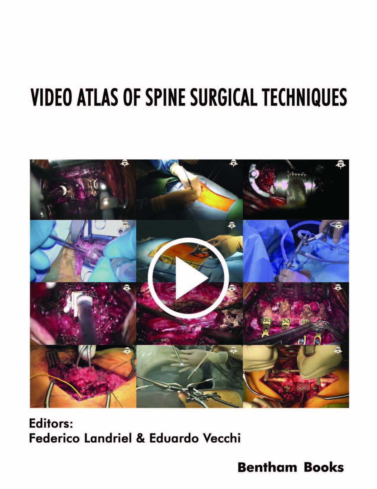 Video Atlas of Spine Surgical Techniques