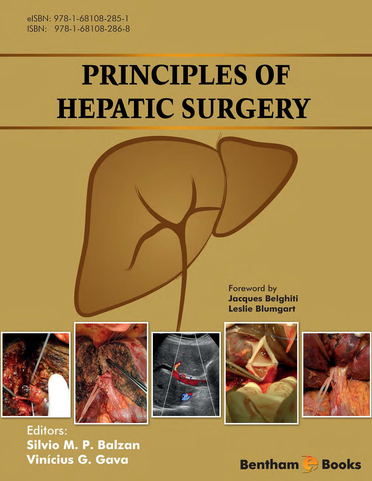 Principles of Hepatic Surgery