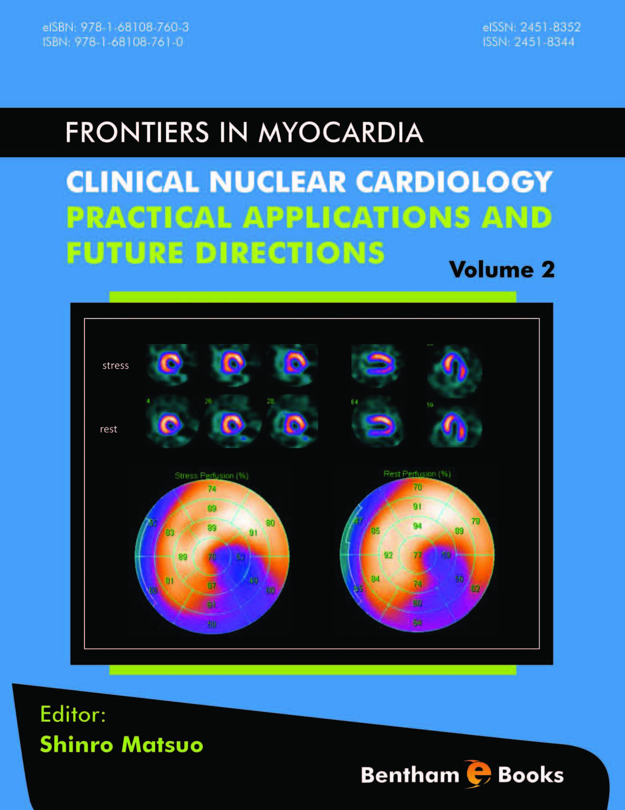 Clinical Nuclear Cardiology: Practical Applications and Future Directions