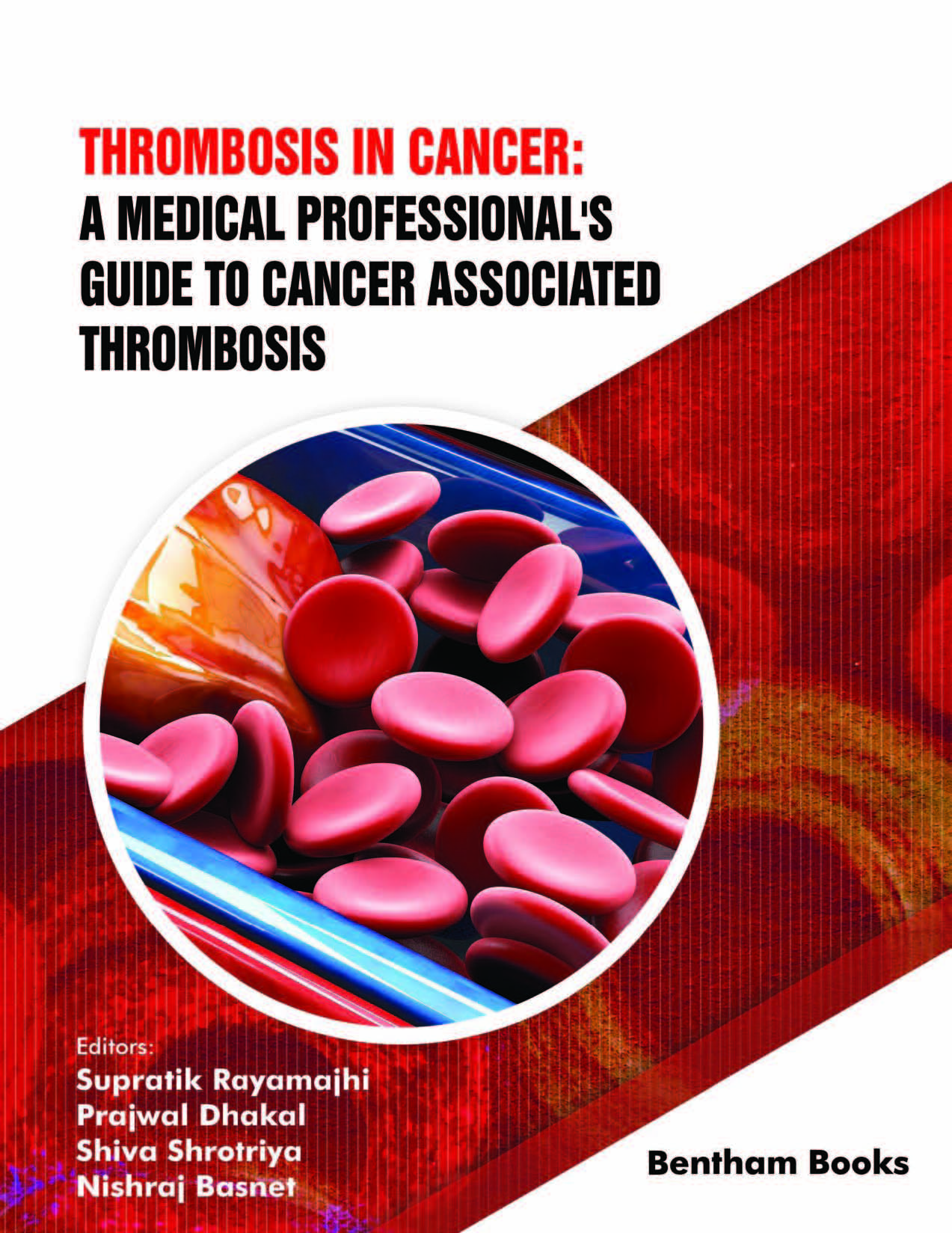 Thrombosis in Cancer: 