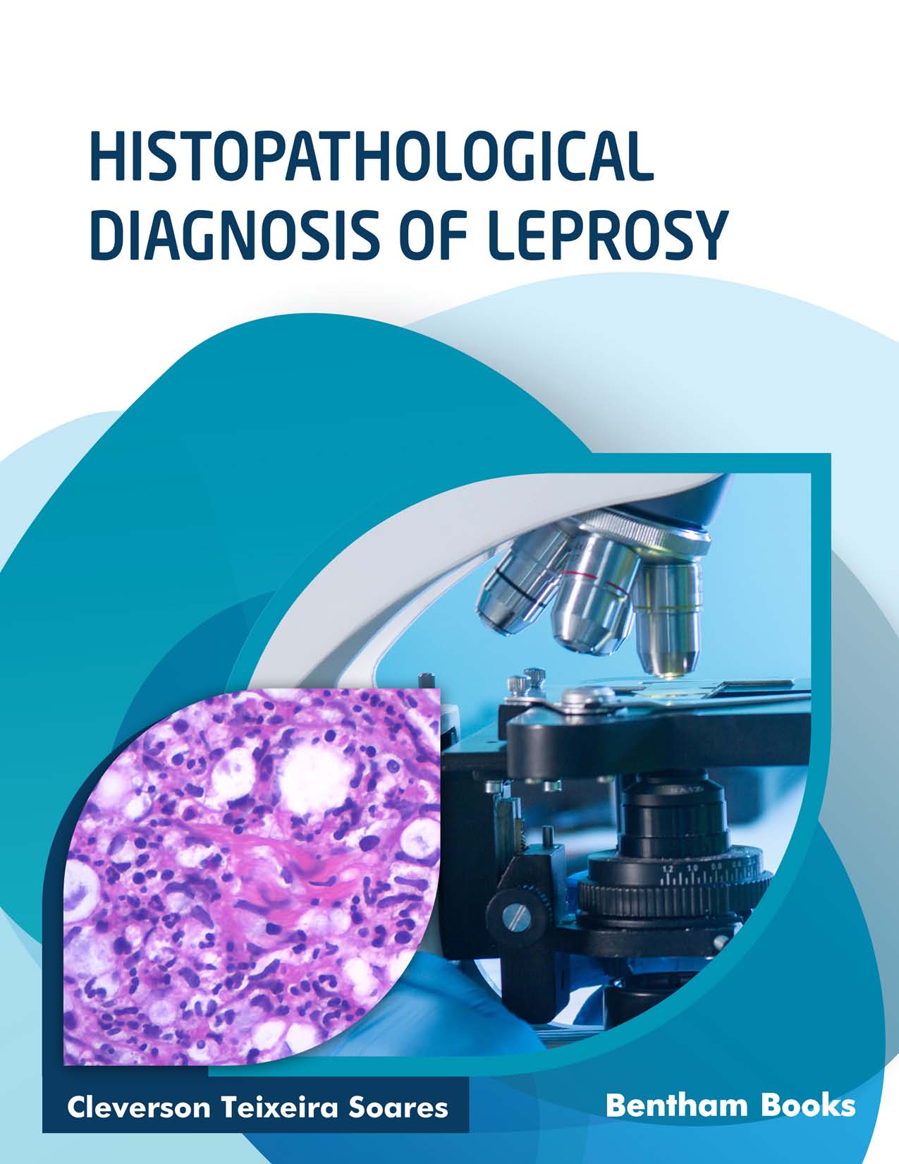 Histopathological Diagnosis of Leprosy