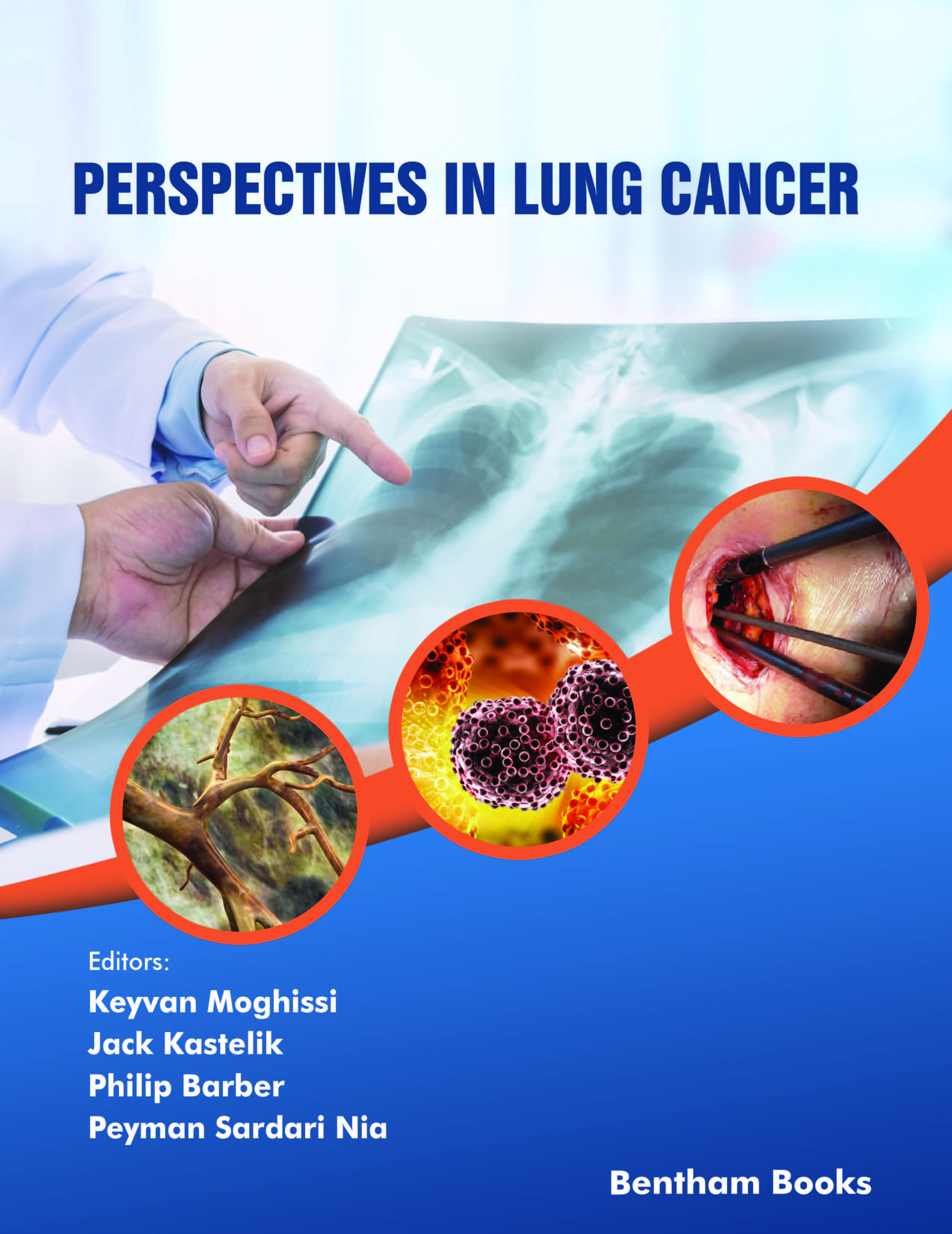 Perspectives in Lung Cancer