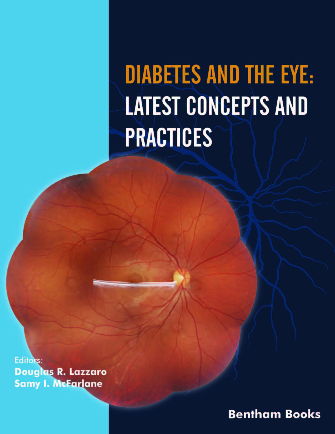 Diabetes and the Eye: Latest Concepts and Practices