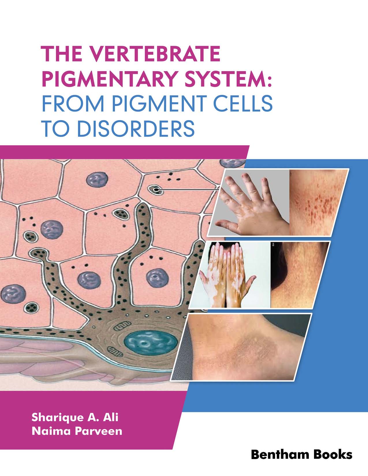 The Vertebrate Pigmentary System: From Pigment Cells to Disorders