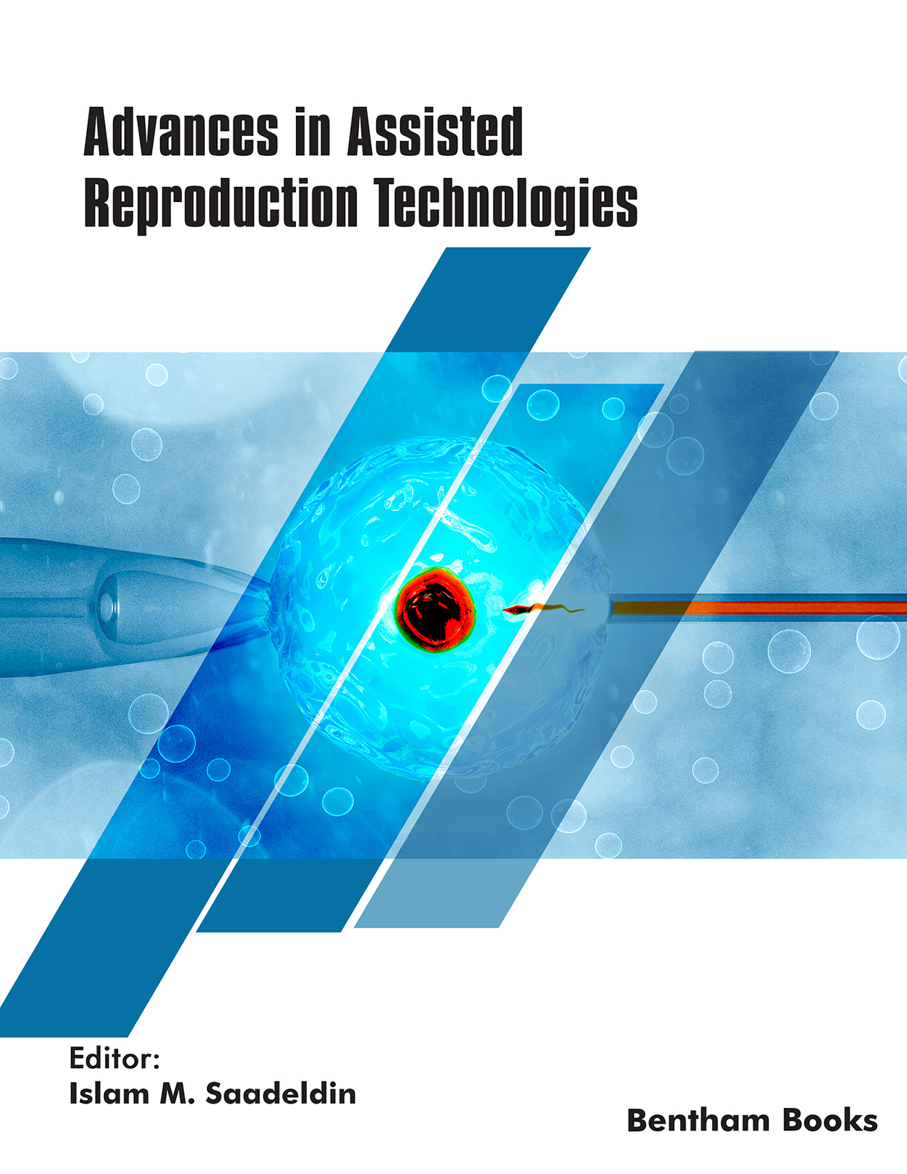 Advances in Assisted Reproduction Technologies