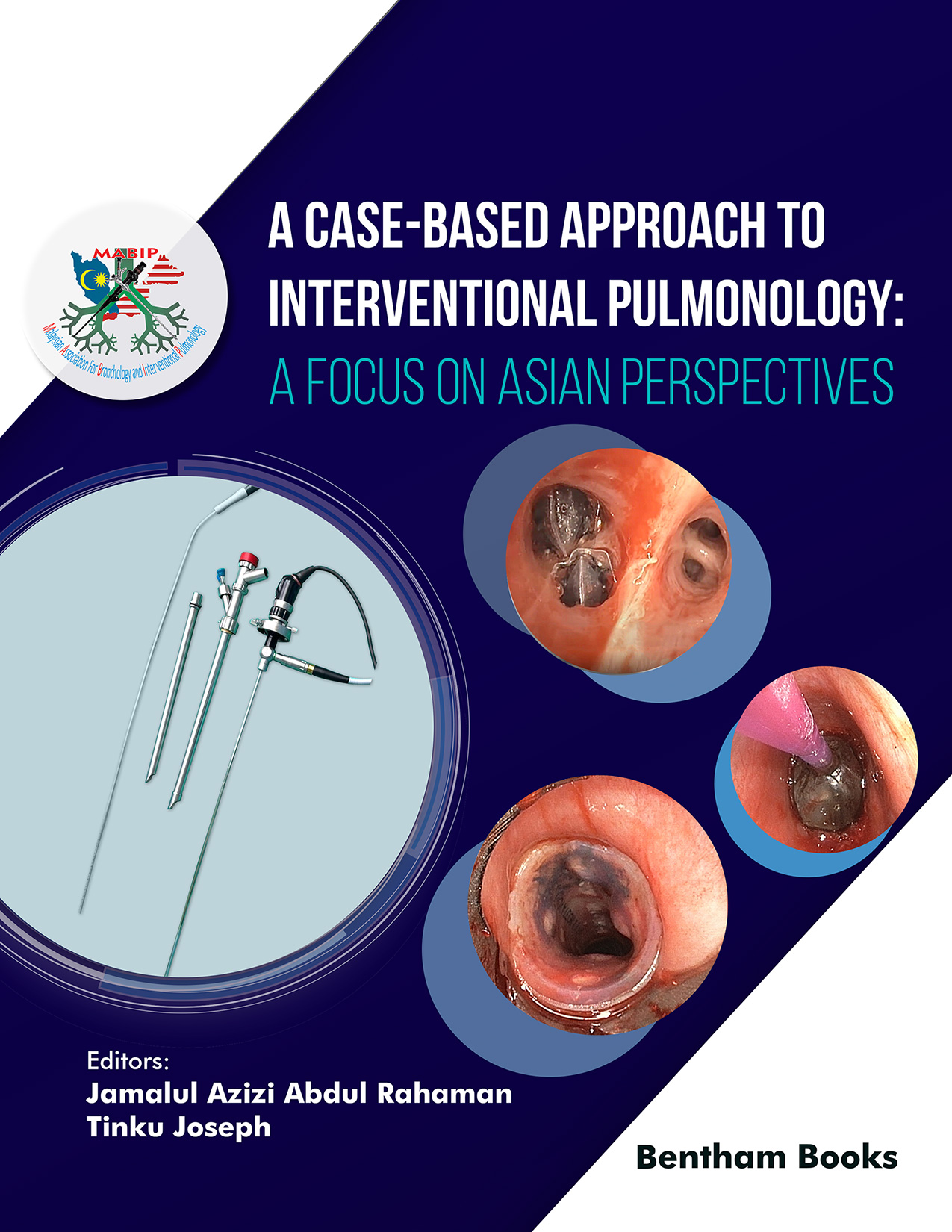 A Case-Based Approach to Interventional Pulmonology: A Focus on Asian Perspectives