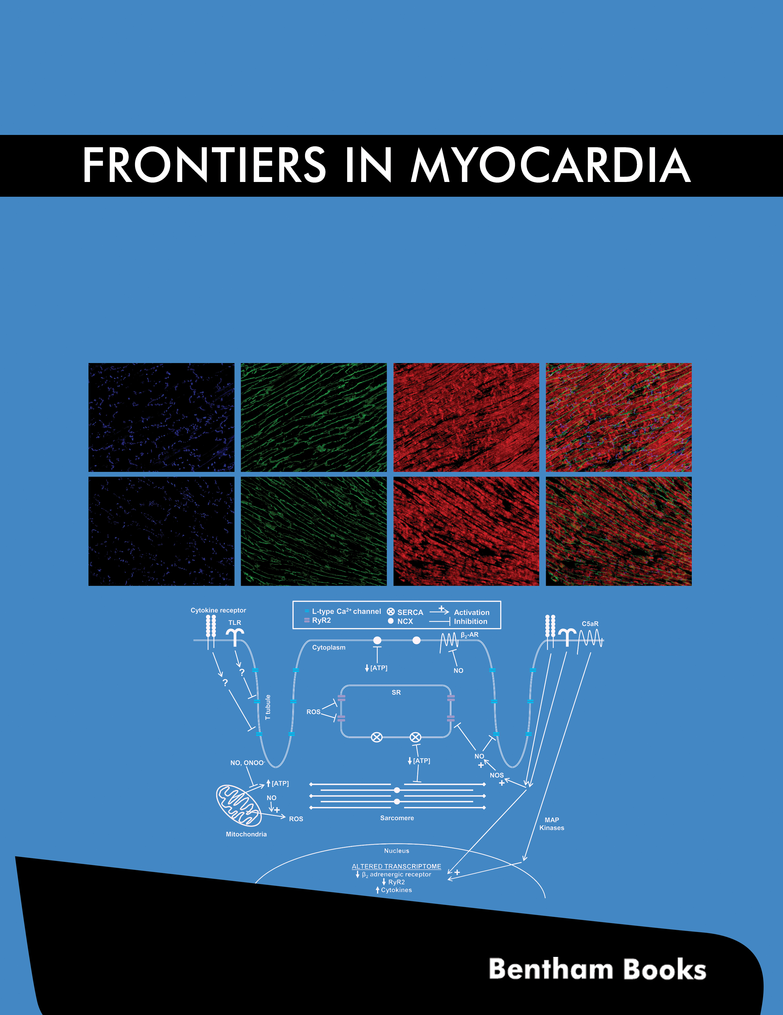 Frontiers in Myocardia Frontiers in Myocardia