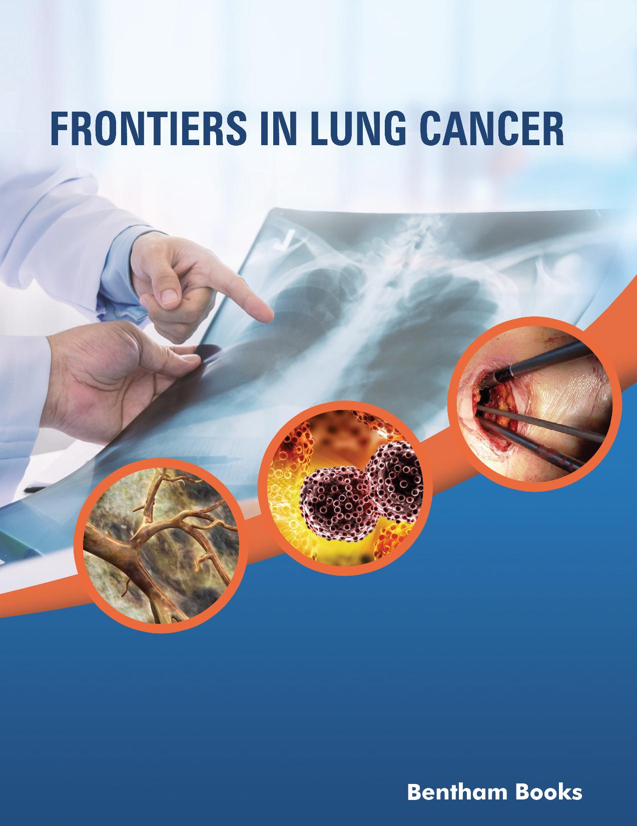 Frontiers in Lung Cancer Frontiers in Lung Cancer