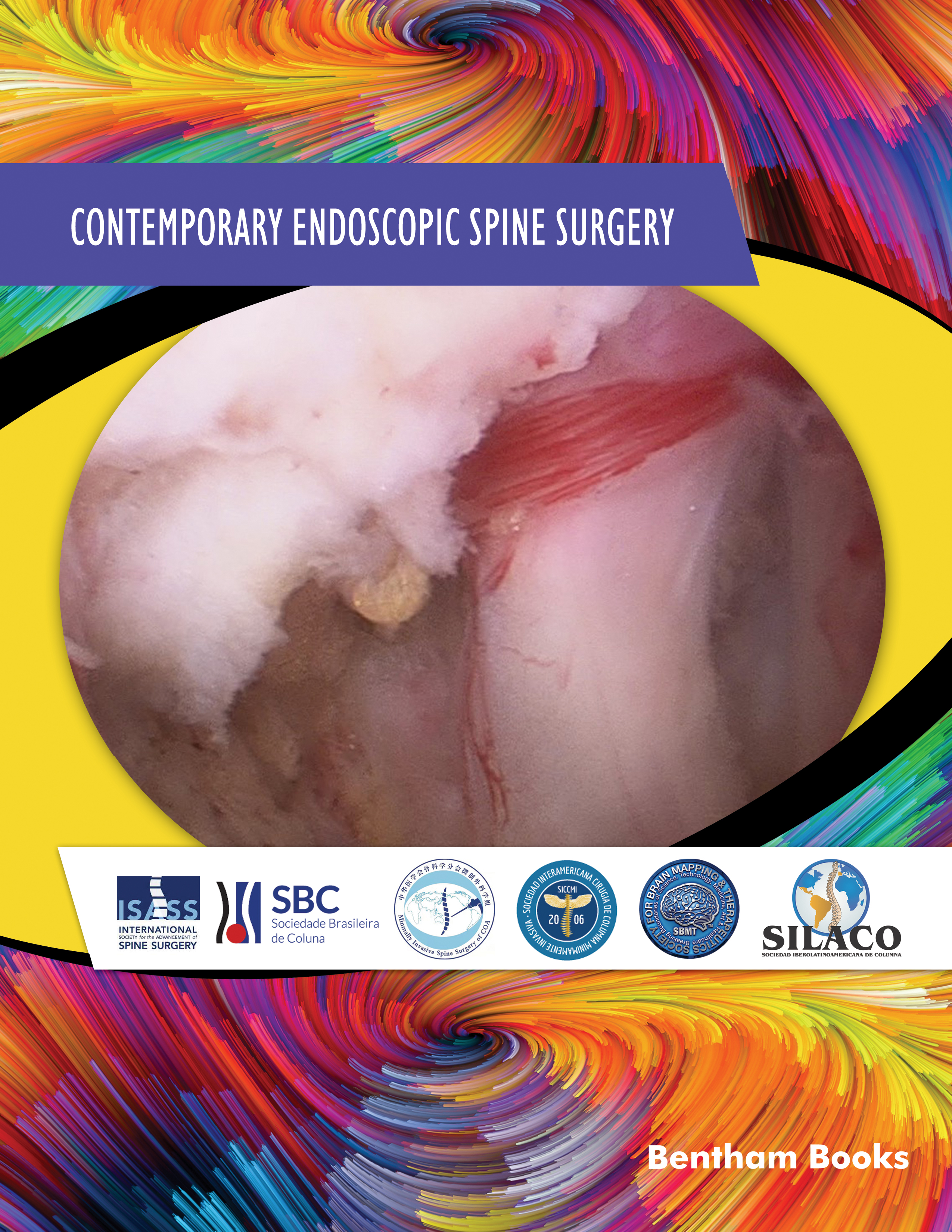 Contemporary Endoscopic Spine Surgery Contemporary Endoscopic Spine Surgery
